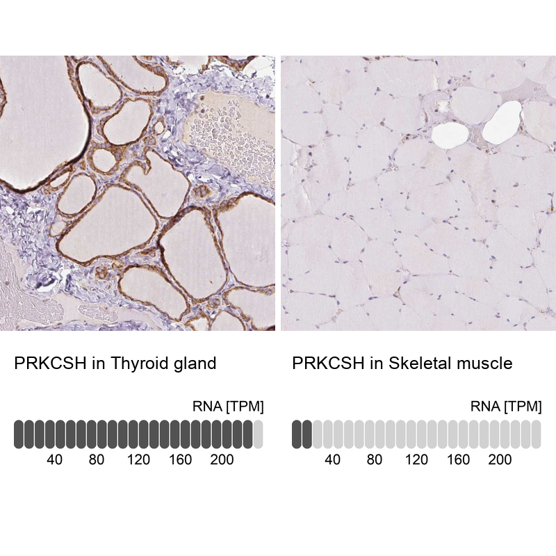 Atlas Antibodies Anti-PRKCSH Antibody