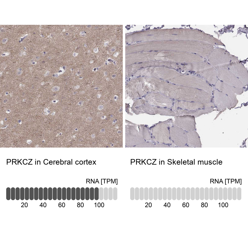 Atlas Antibodies Anti-PRKCZ Antibody