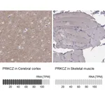 Atlas Antibodies Anti-PRKCZ Antibody
