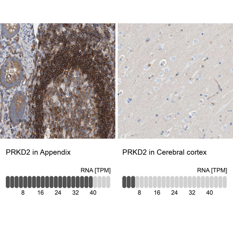 Atlas Antibodies Anti-PRKD2 Antibody