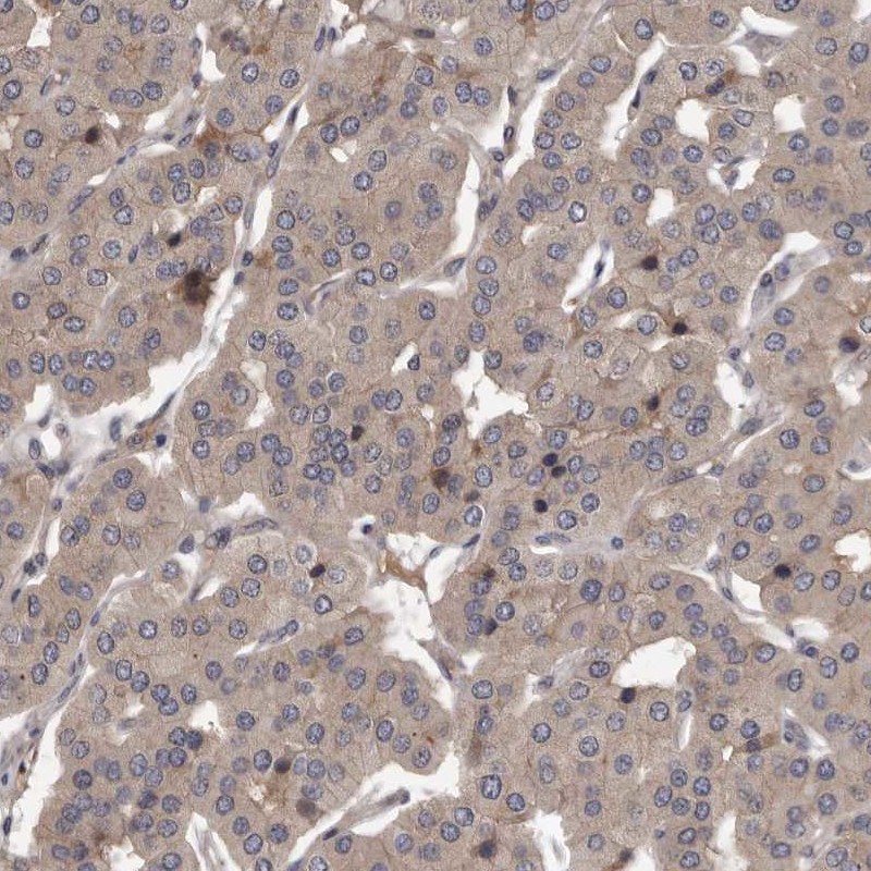 Atlas Antibodies Anti-PRKD1 Antibody