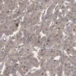 Atlas Antibodies Anti-PRKD1 Antibody