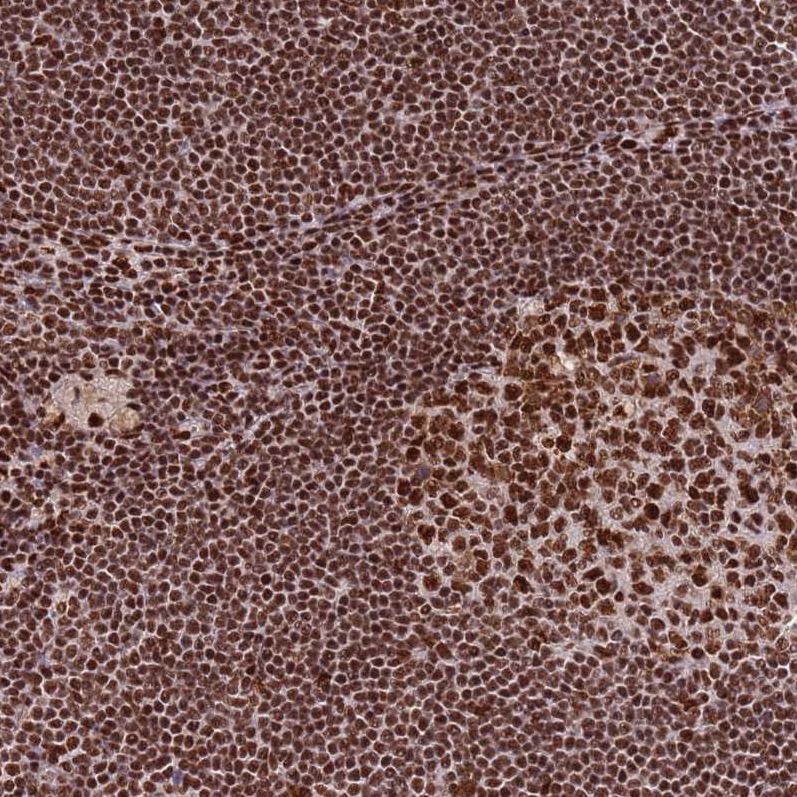 Atlas Antibodies Anti-PRKDC Antibody