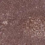 Atlas Antibodies Anti-PRKDC Antibody