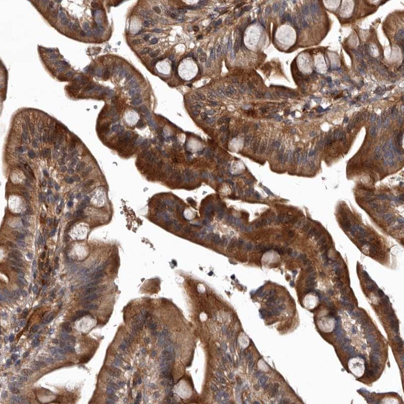 Atlas Antibodies Anti-PRKD3 Antibody