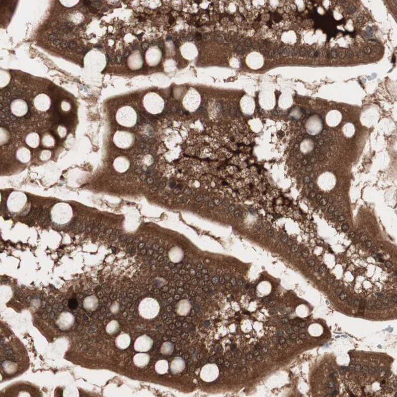Atlas Antibodies Anti-PRKG2 Antibody