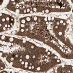 Atlas Antibodies Anti-PRKG2 Antibody