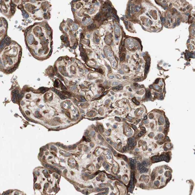 Atlas Antibodies Anti-PRKG1 Antibody