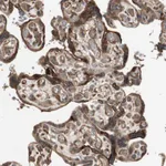 Atlas Antibodies Anti-PRKG1 Antibody