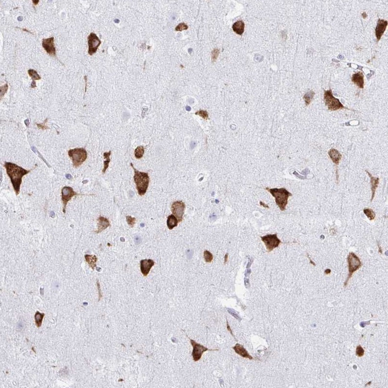 Atlas Antibodies Anti-PRKRA Antibody