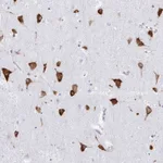 Atlas Antibodies Anti-PRKRA Antibody