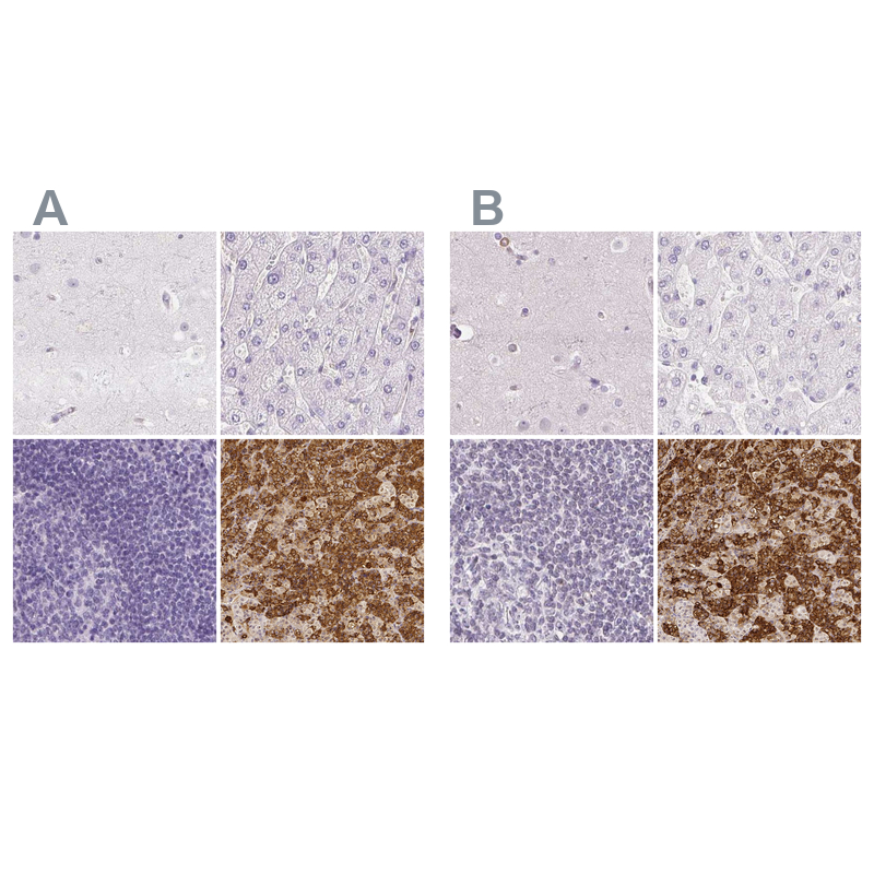 Atlas Antibodies Anti-PRL Antibody