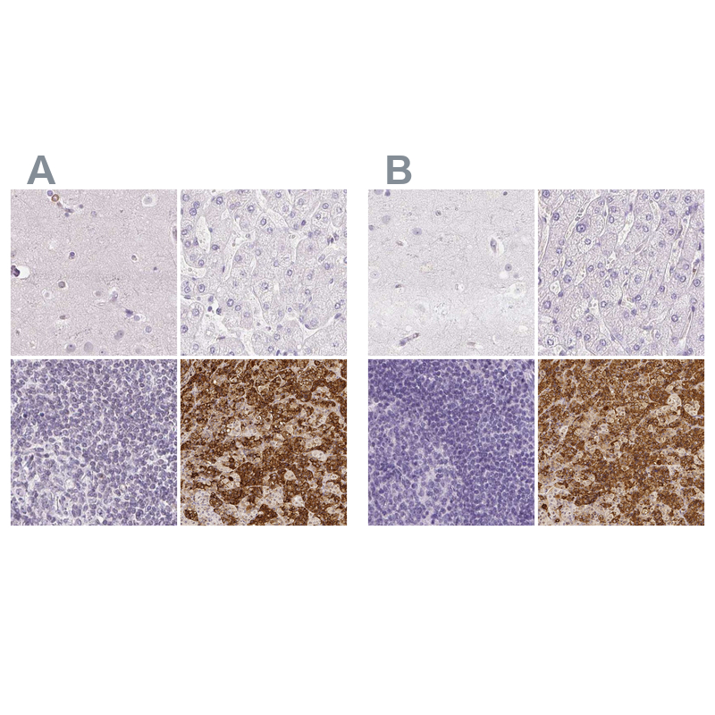 Atlas Antibodies Anti-PRL Antibody