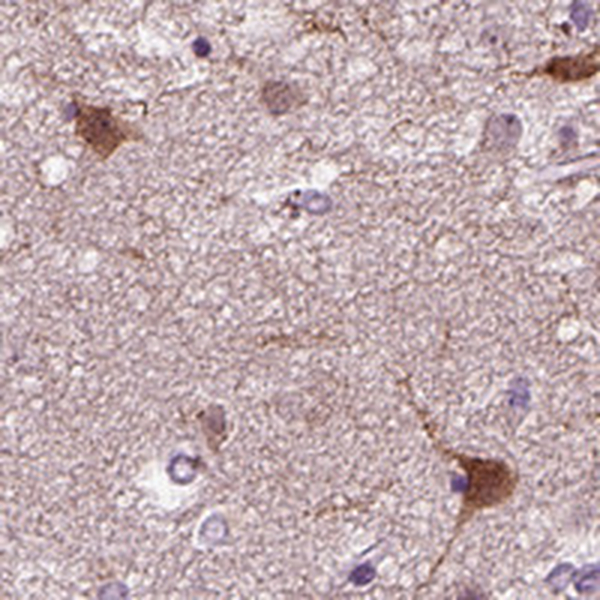 Atlas Antibodies Anti-PRLH Antibody