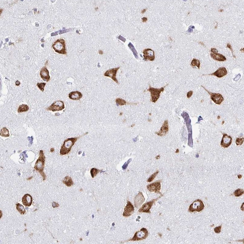 Atlas Antibodies Anti-PRKRA Antibody