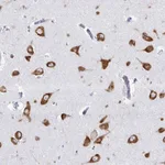 Atlas Antibodies Anti-PRKRA Antibody
