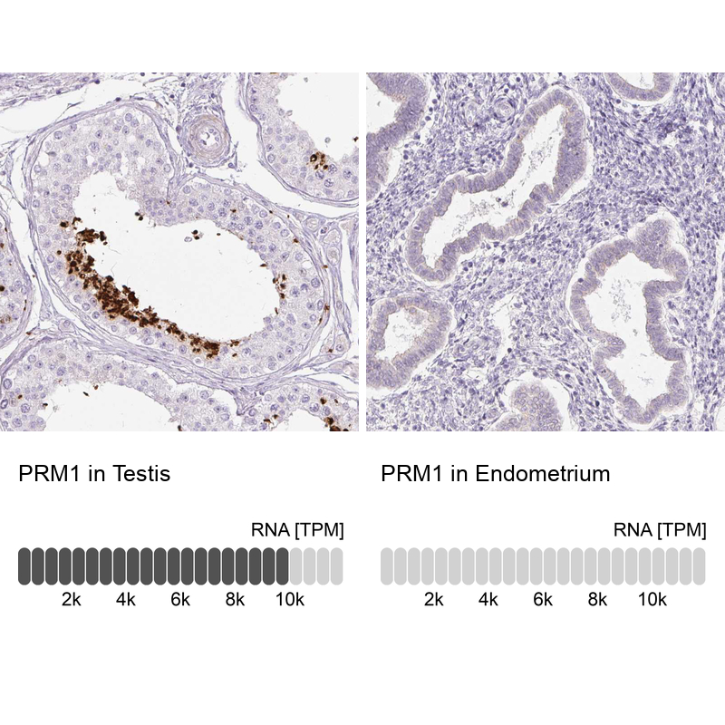 Atlas Antibodies Anti-PRM1 Antibody