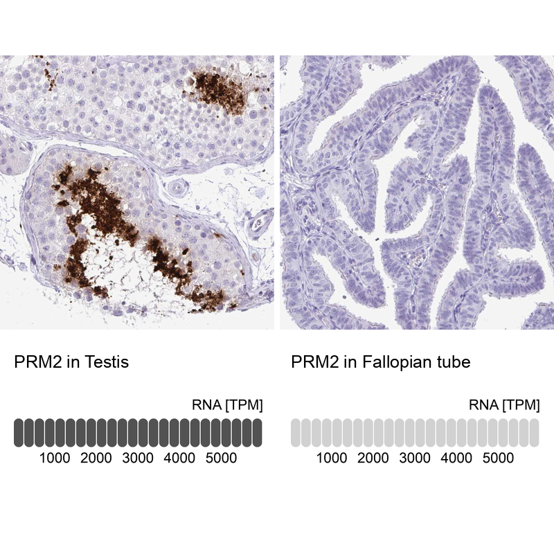 Atlas Antibodies Anti-PRM2 Antibody
