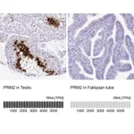 Atlas Antibodies Anti-PRM2 Antibody