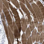 Atlas Antibodies Anti-PRMT2 Antibody