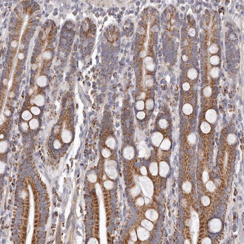 Atlas Antibodies Anti-PRMT2 Antibody