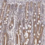 Atlas Antibodies Anti-PRMT2 Antibody