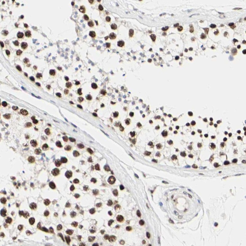 Atlas Antibodies Anti-PRMT3 Antibody