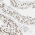 Atlas Antibodies Anti-PRMT3 Antibody