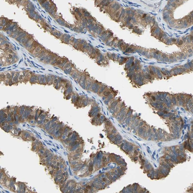 Atlas Antibodies Anti-PRMT5 Antibody