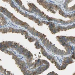Atlas Antibodies Anti-PRMT5 Antibody