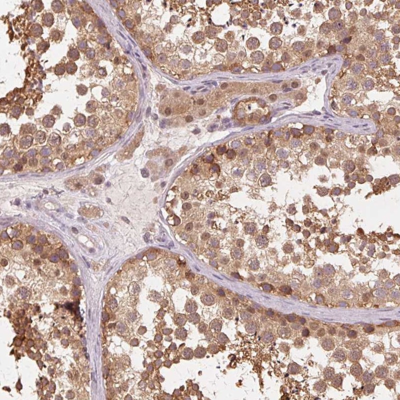 Atlas Antibodies Anti-PRMT5 Antibody