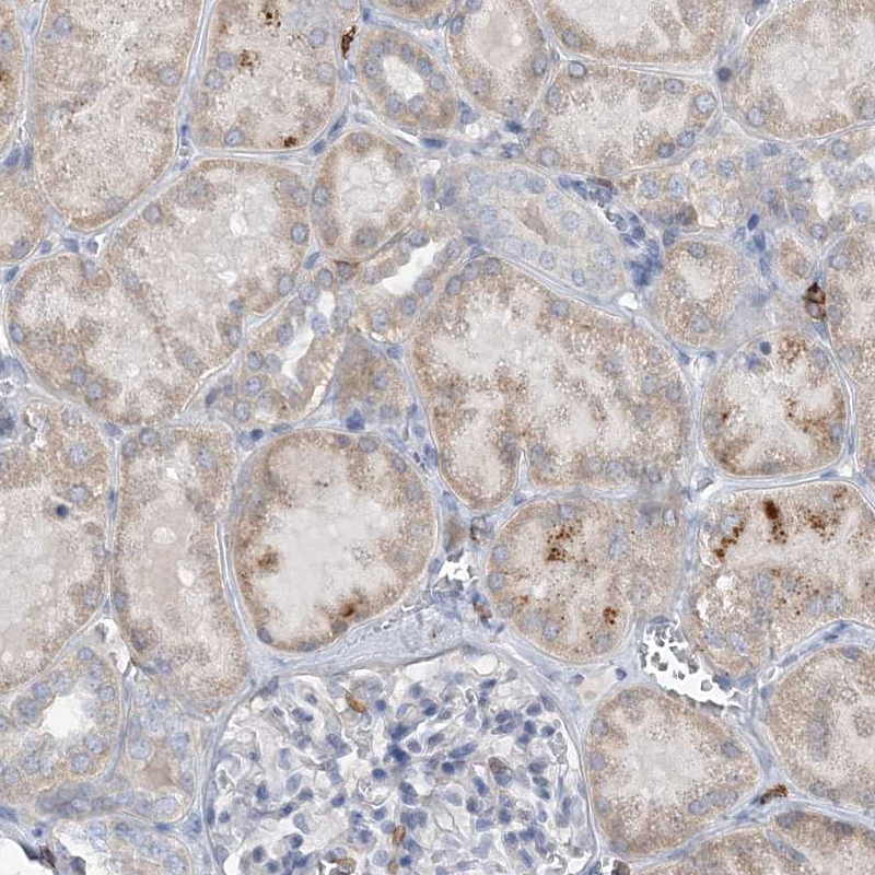 Atlas Antibodies Anti-PRMT9 Antibody