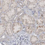 Atlas Antibodies Anti-PRMT9 Antibody