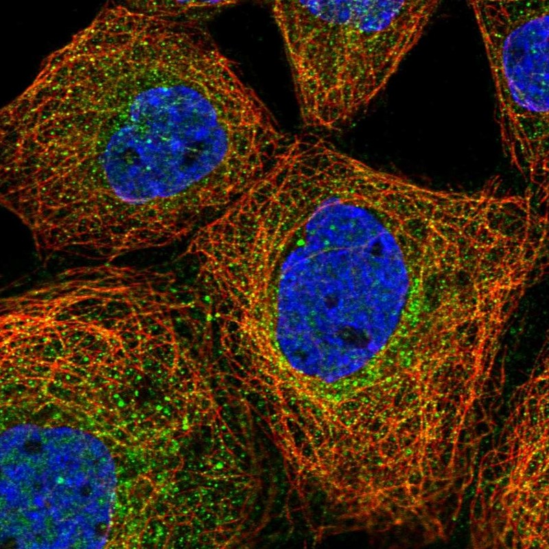 Atlas Antibodies Anti-PRMT9 Antibody