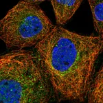 Atlas Antibodies Anti-PRMT9 Antibody
