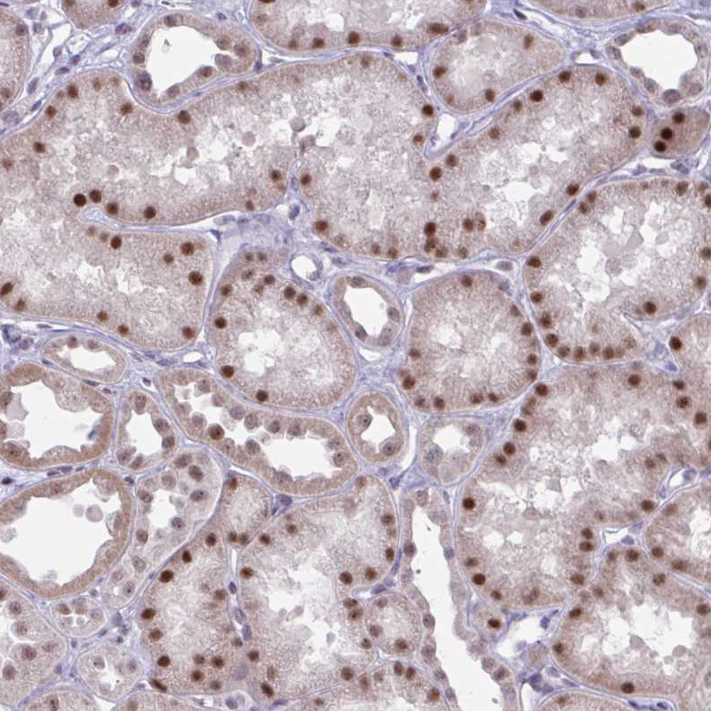 Atlas Antibodies Anti-PRMT6 Antibody