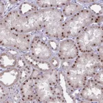 Atlas Antibodies Anti-PRMT6 Antibody