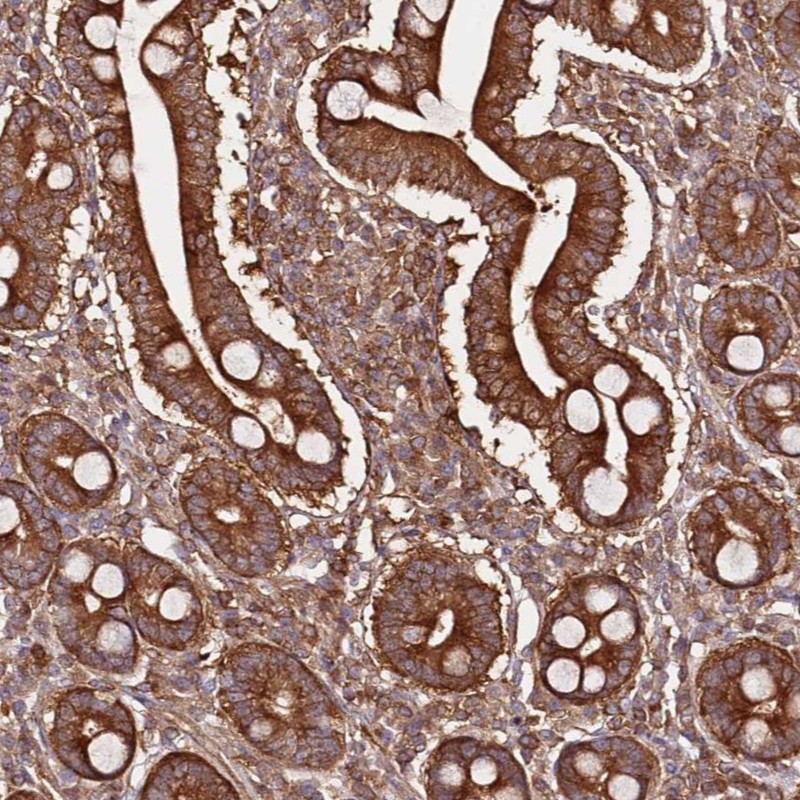 Atlas Antibodies Anti-PRMT7 Antibody