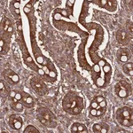 Atlas Antibodies Anti-PRMT7 Antibody