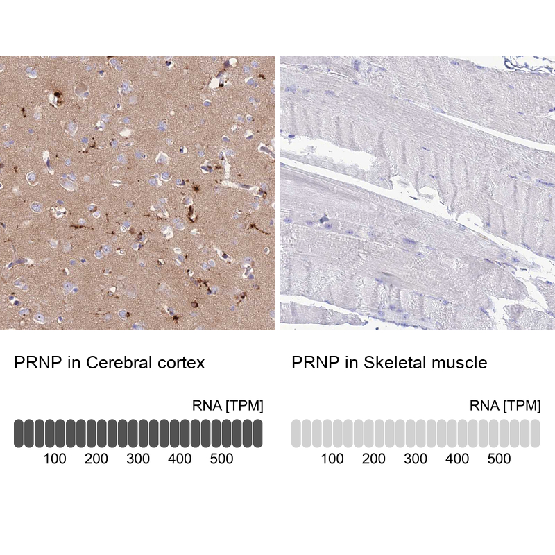 Atlas Antibodies Anti-PRNP Antibody