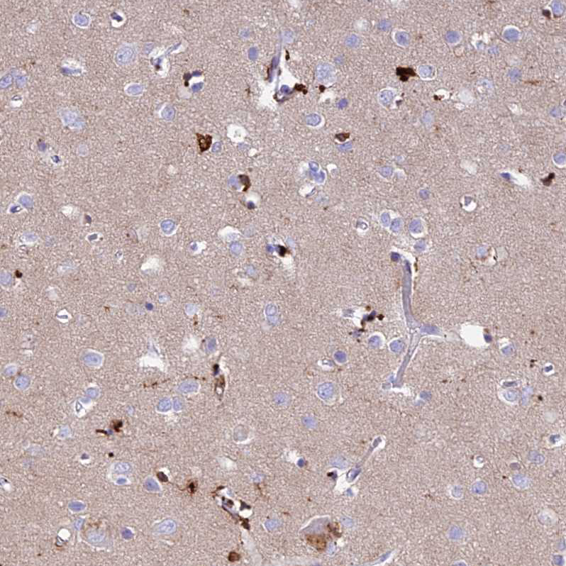 Atlas Antibodies Anti-PRNP Antibody