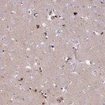 Atlas Antibodies Anti-PRNP Antibody