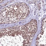 Atlas Antibodies Anti-PRNT Antibody