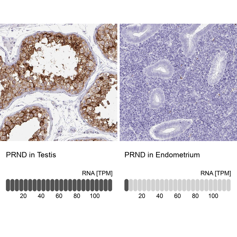 Atlas Antibodies Anti-PRND Antibody