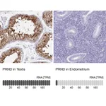Atlas Antibodies Anti-PRND Antibody