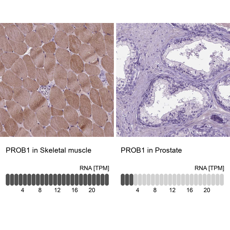 Atlas Antibodies Anti-PROB1 Antibody