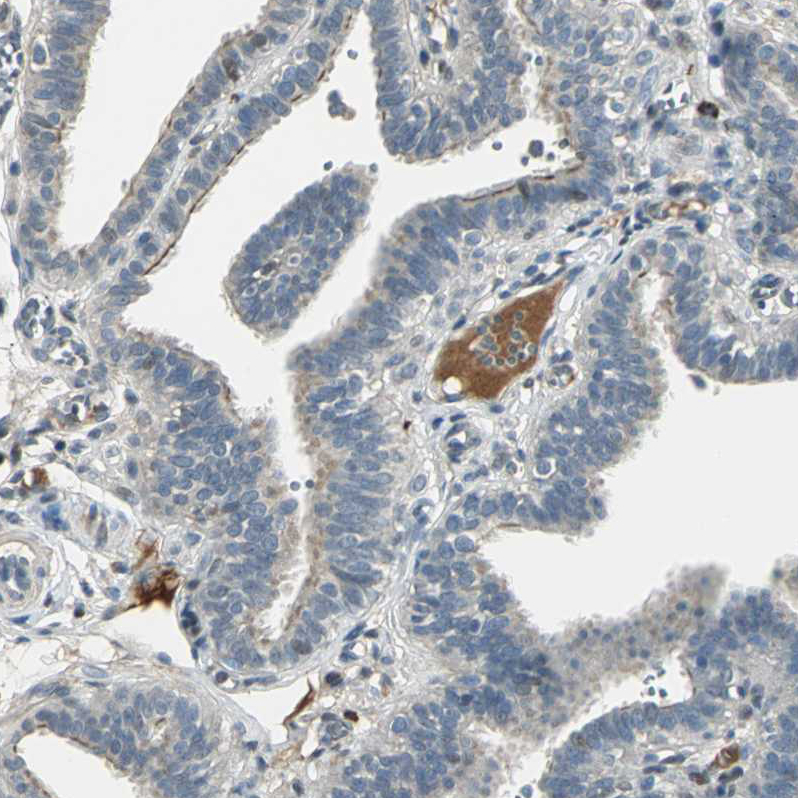 Atlas Antibodies Anti-PROC Antibody