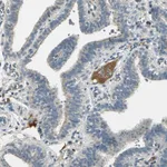 Atlas Antibodies Anti-PROC Antibody