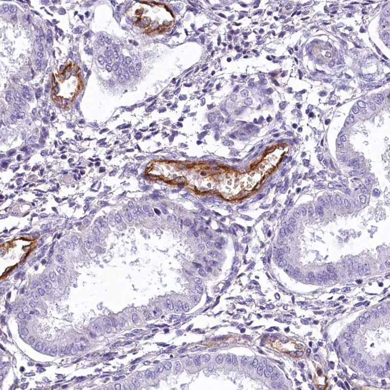 Atlas Antibodies Anti-PROCR Antibody