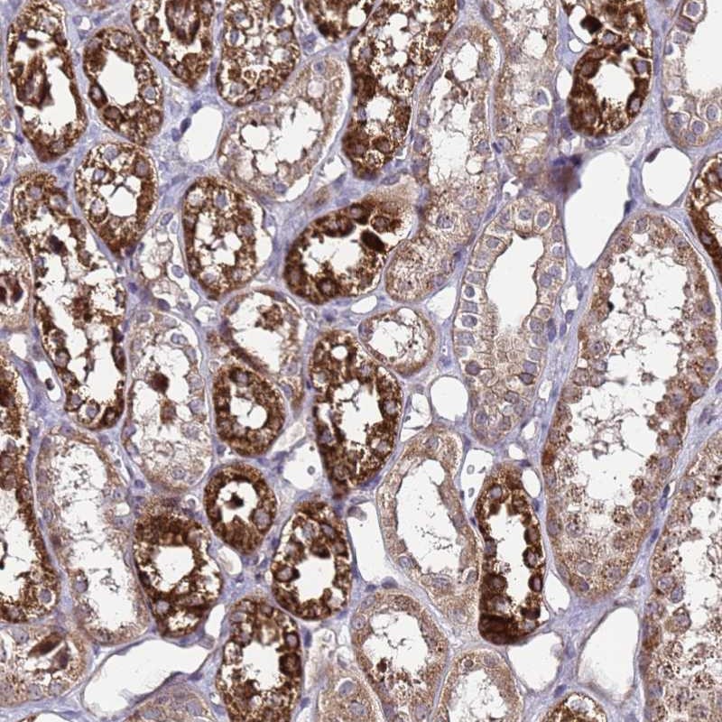 Atlas Antibodies Anti-PRODH Antibody